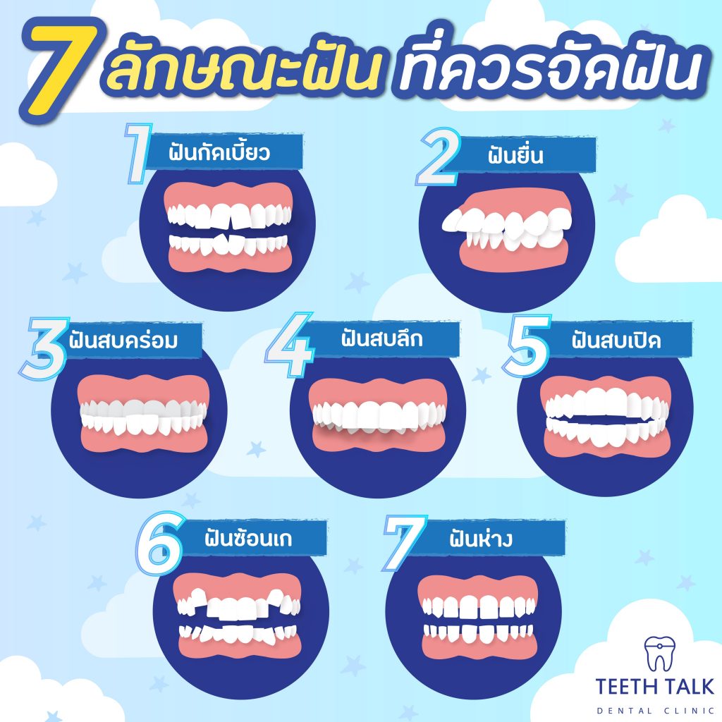 จัดฟัน