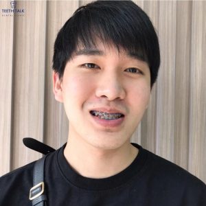 รีวิวจากลูกค้า ที่มาใช้บริการ จัดฟัน ที่ Teeth Talk Dental Clinic