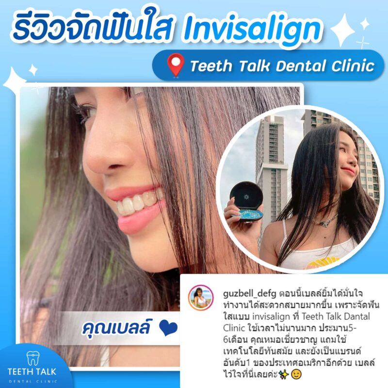 รีวิวจัดฟันใสจากผู้ใช้จริง