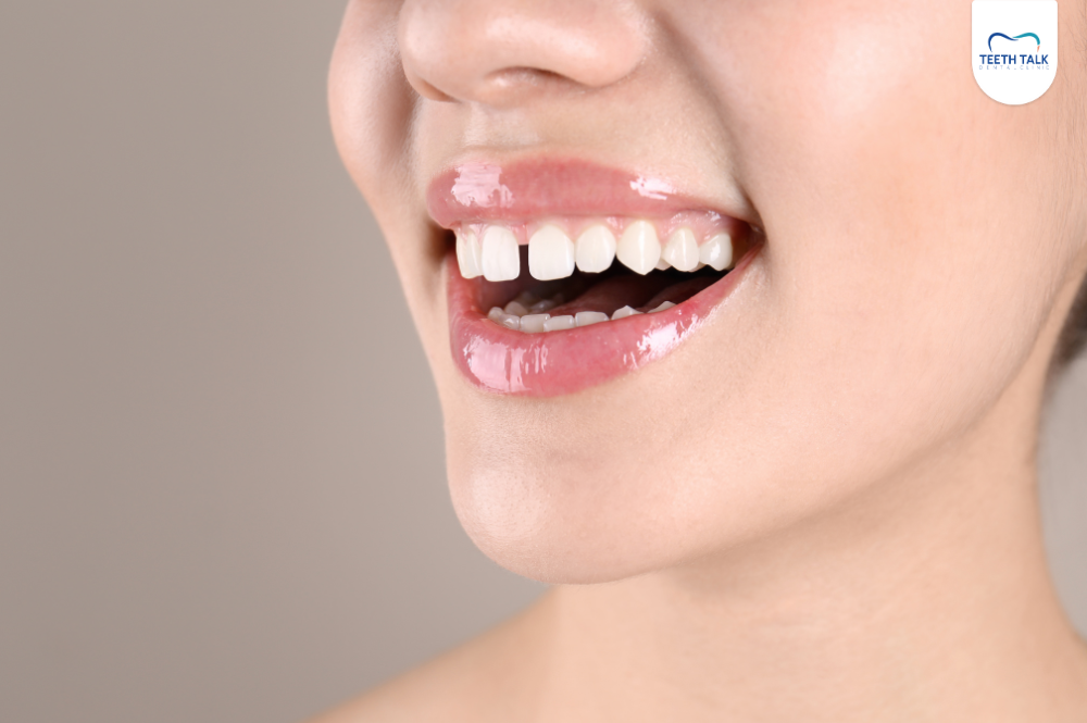 สาเหตุของฟันห่าง