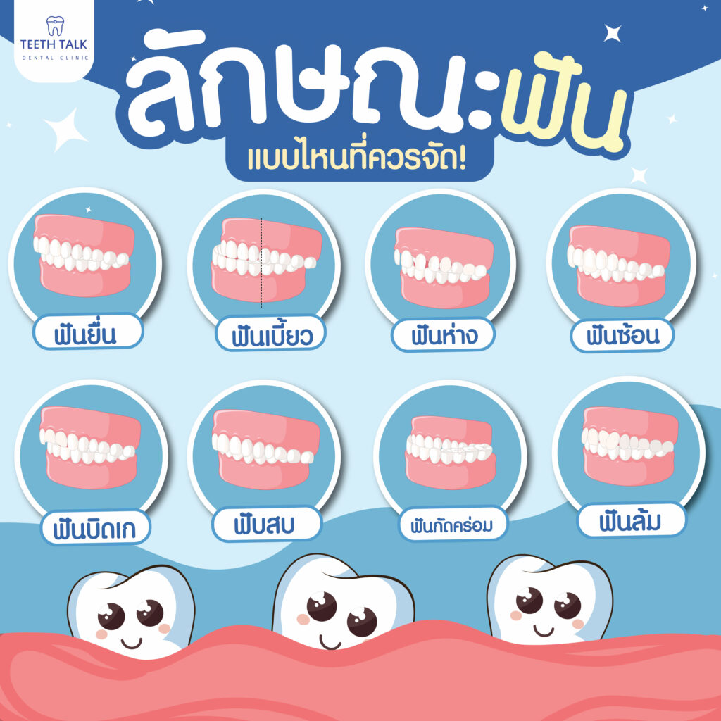 ลักษณะฟันสวย