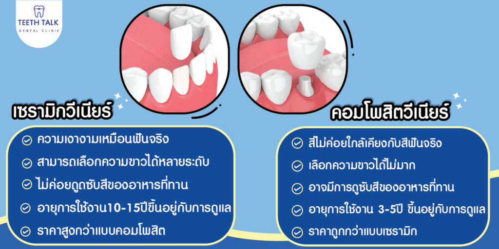 ประเภทวีเนียร์