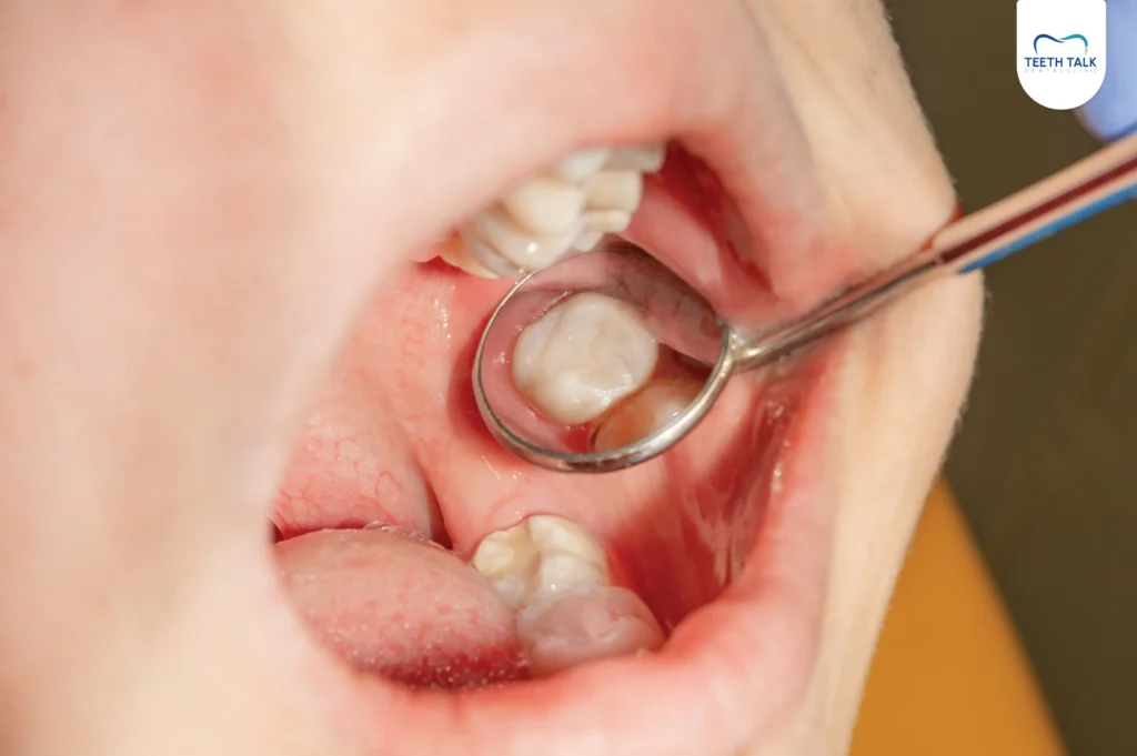 ปวดฟันกรามเกิดจากอะไร