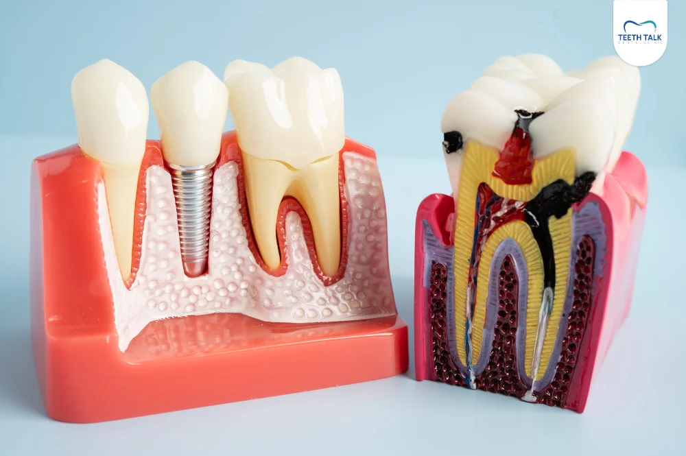 สาเหตุปวดฟันจนปวดหัว