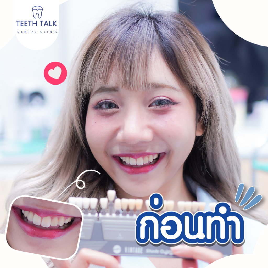 ฟอกสีฟัน