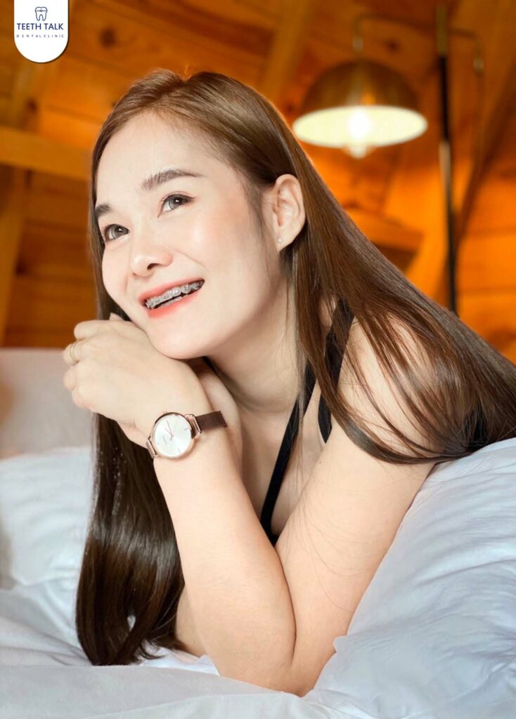 รีวิวจัดฟัน
