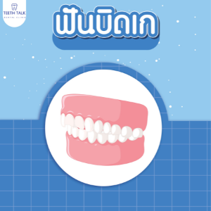 จัดฟันเหล็ก จัดฟันโลหะ ดีไหม ราคาเท่าไหร่ รู้ครบจบทุกคำถาม