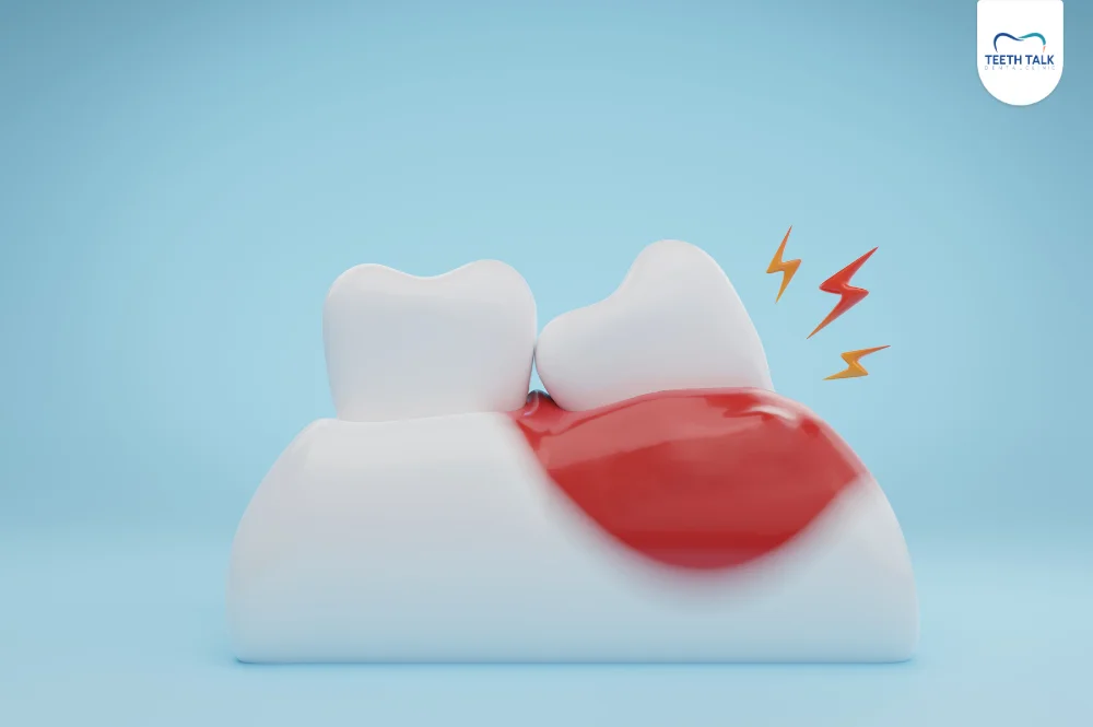 ฟันคุดคืออะไร