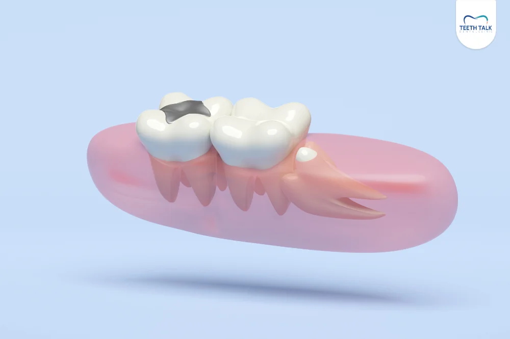 ฟันคุด คืออะไร? อาการแบบไหนที่ใช่ สาเหตุ และวิธีรักษาที่ควรรู้