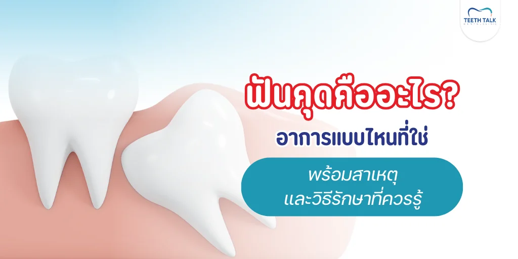 ฟันคุด