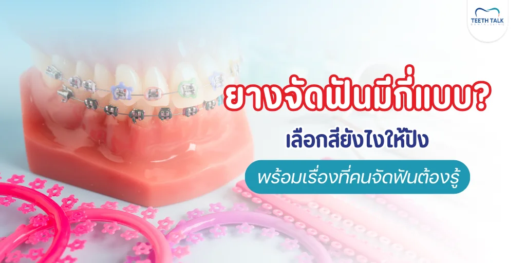 ยางจัดฟัน