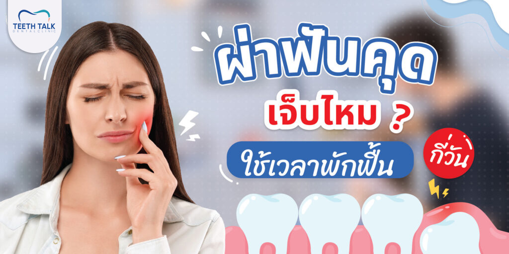 ผ่าฟันคุด ราคาเท่าไหร่ เจ็บไหม ? ใช้เวลาพักฟื้นกี่วัน
