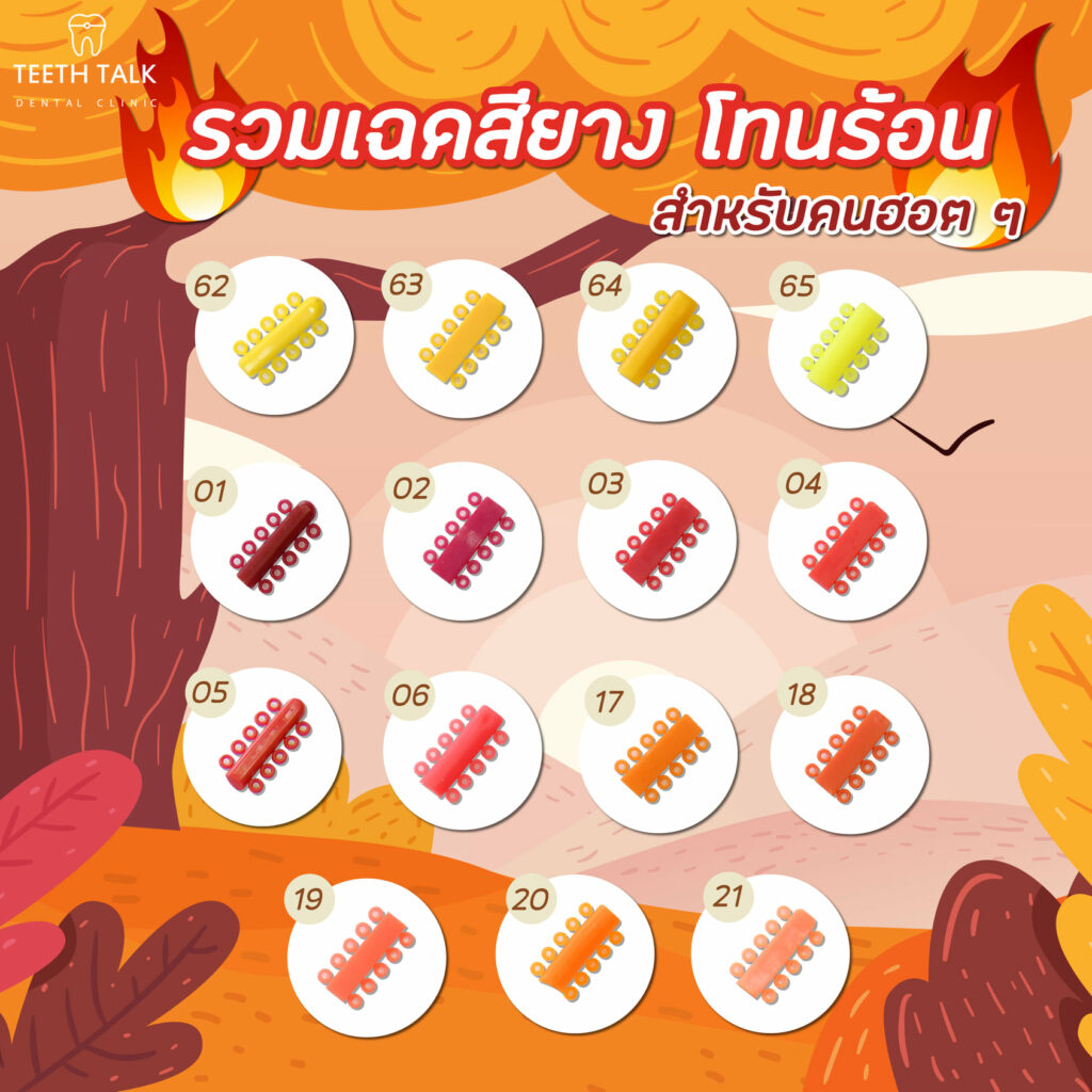 จัดฟันเหล็ก