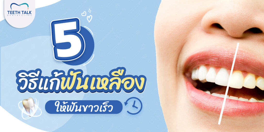 5 วิธีแก้ฟันเหลือง ให้ฟันขาวเร็วมีวิธีไหนบ้าง?