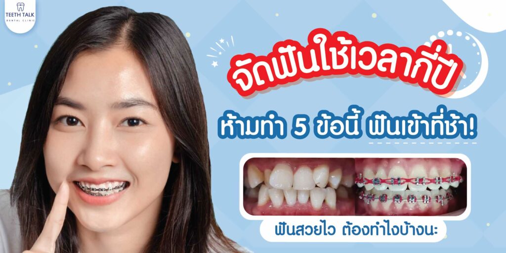 จัดฟันใช้เวลากี่ปี ฟันไม่เข้าที่เพราะทำ 5 ข้อนี้อยู่หรือเปล่า! จัดฟันใช้เวลากี่ปี ฟันไม่เข้าที่เพราะทำ 5 ข้อนี้อยู่หรือเปล่า!