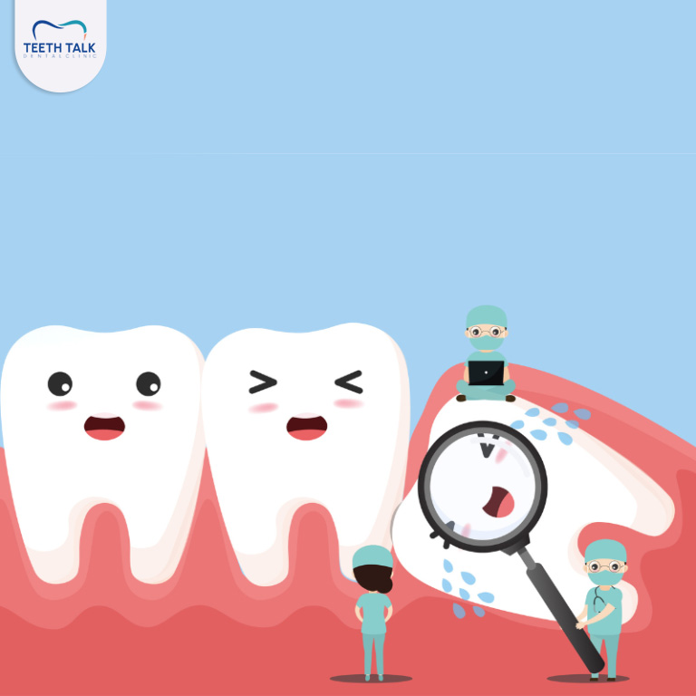 ผ่าฟันคุด