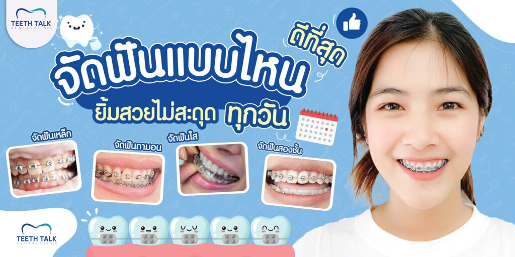 จัดฟันแบบไหนดีที่สุด ยิ้มสวยไม่สะดุดทุกวัน!