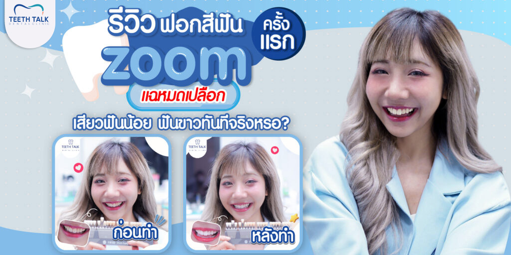 รีวิวฟอกสีฟัน ZOOM ครั้งแรก แฉหมดเปลือก เสียวฟันน้อย ขาวทันทีจริงหรอ ?