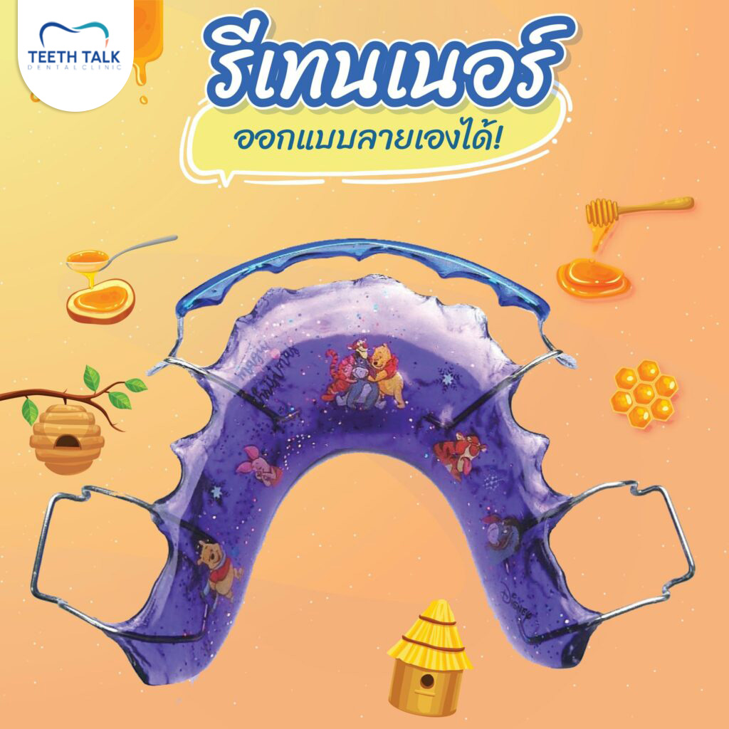 แถมรีเทนเนอร์ให้ฟรี