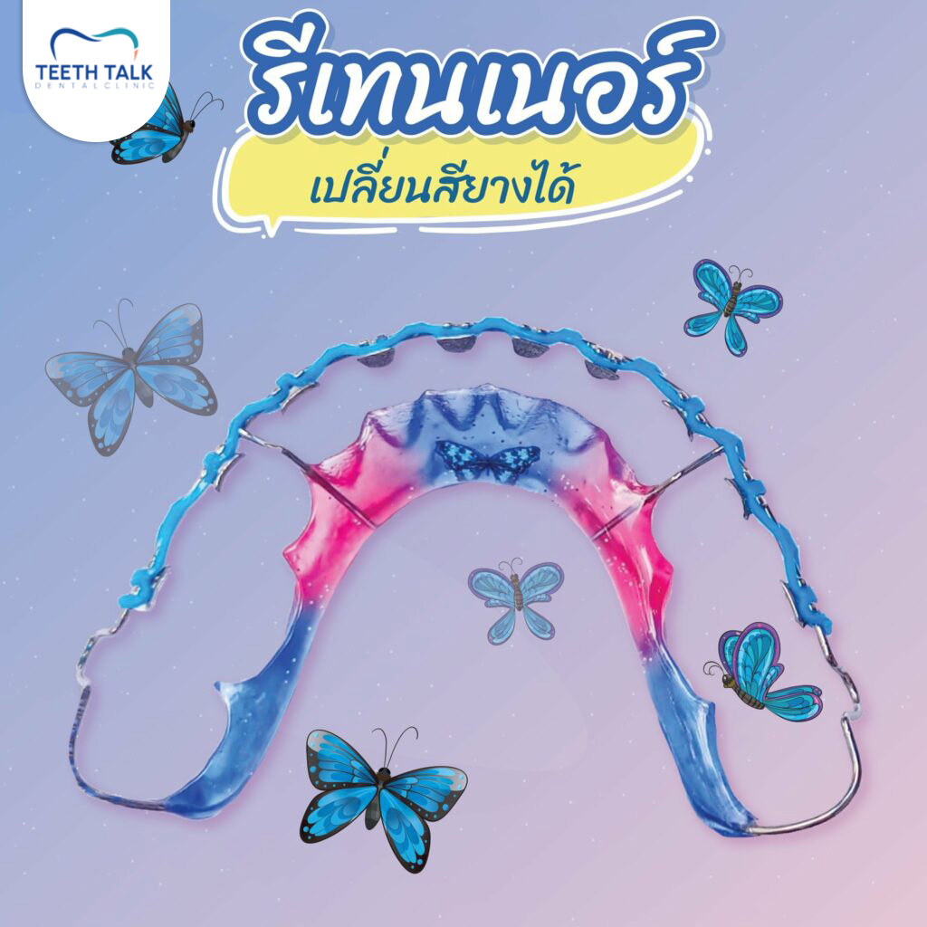 แถมรีเทนเนอร์ให้ฟรี