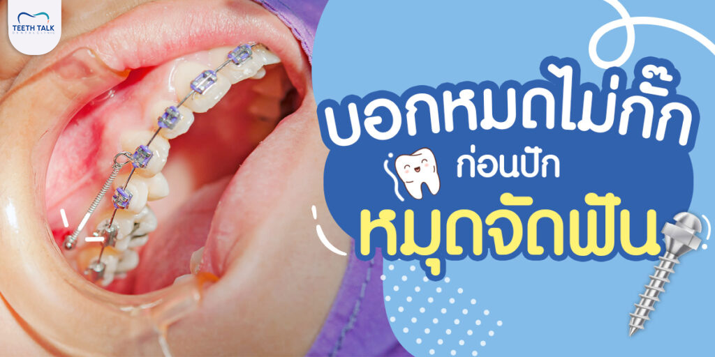 บอกหมดไม่กั๊ก ก่อนปักหมุดจัดฟัน