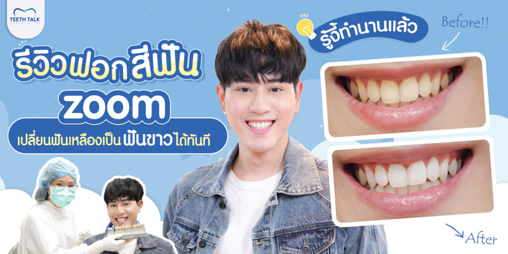 ฟอกสีฟัน ZOOM 45 นาทีที่ฉันรอเธอ คราบชา กาแฟ หายเกลี้ยง ฟันขาวขึ้นได้ขนาดนี้จริงหรอ ?