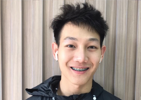 จัดฟันราคาเริ่มต้นเท่าไหร่