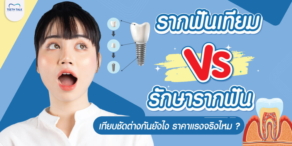 ไขข้อสงสัย เกี่ยวกับ “รากฟันเทียม” และ “การรักษารากฟัน”