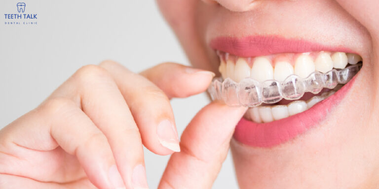 จัดฟันแบบไหนดีที่สุด เร็วที่สุด คลายความสงสัยไปพร้อมกันในบทความนี้