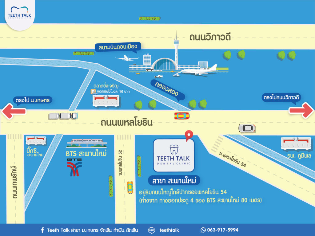 where-to-get-braces-saphan-mai_01 คลินิกจัดฟันสะพานใหม่ที่ไหนดี? ที่ไหนเชื่อถือได้?