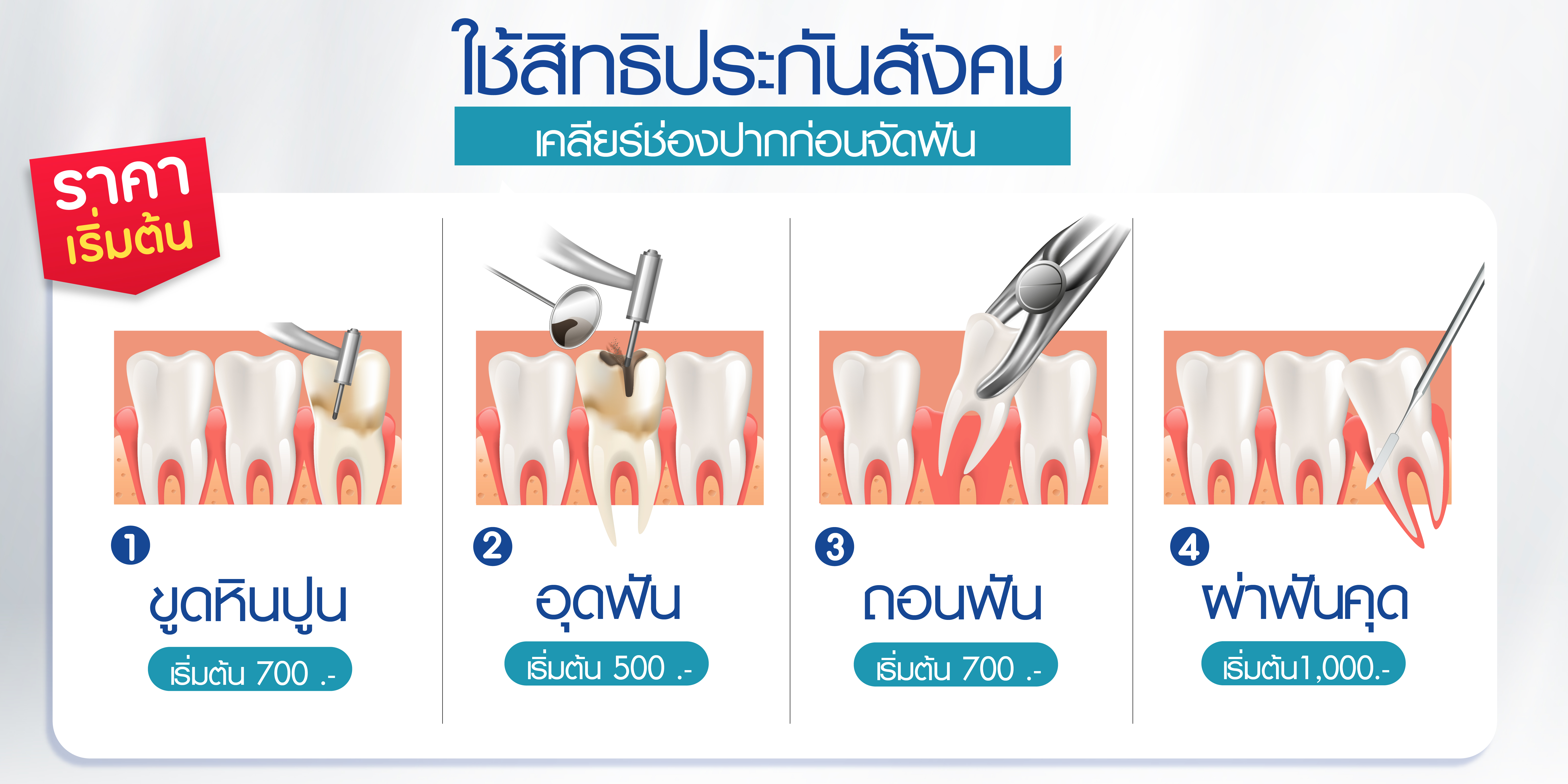 ใช้สิทธิประกันสังคม ทำฟัน