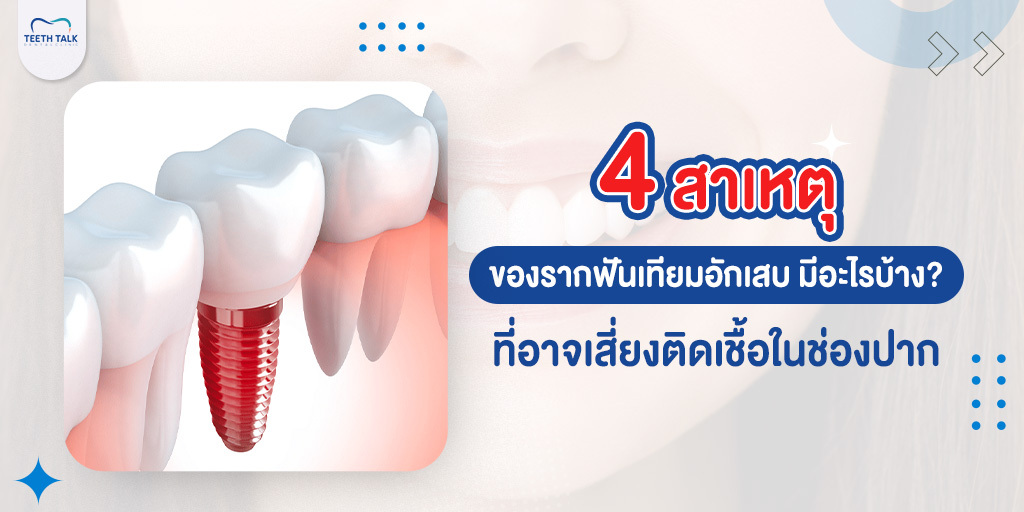 4 สาเหตุของ รากฟันเทียมอักเสบ มีอะไรบ้าง? ที่อาจเสี่ยงติดเชื้อในช่องปาก