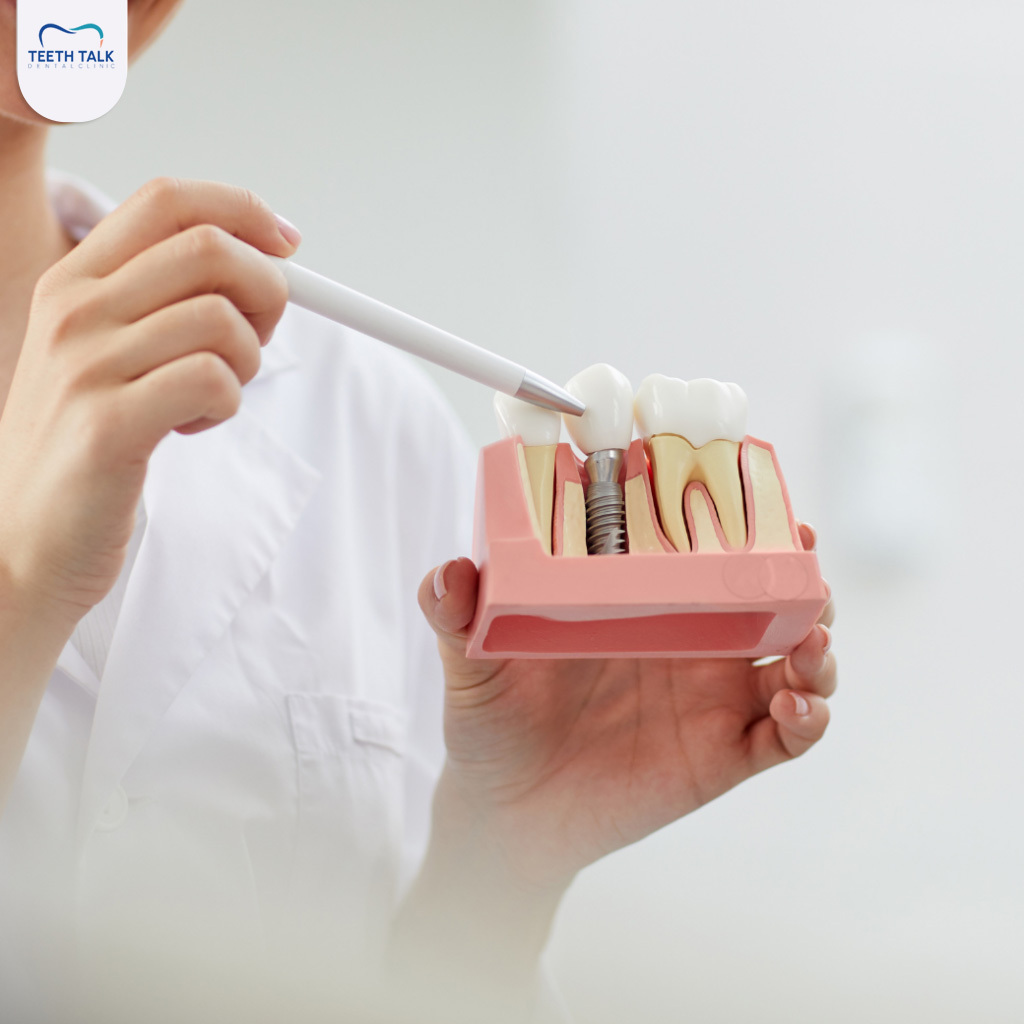 สาเหตุของรากฟันเทียมอักเสบ