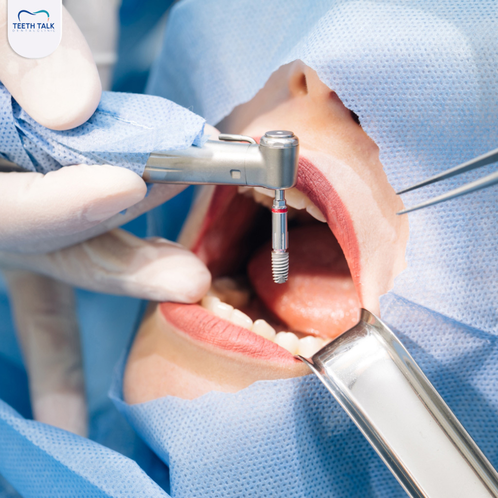 4 สาเหตุของ รากฟันเทียมอักเสบ มีอะไรบ้าง? ที่อาจเสี่ยงติดเชื้อในช่องปาก