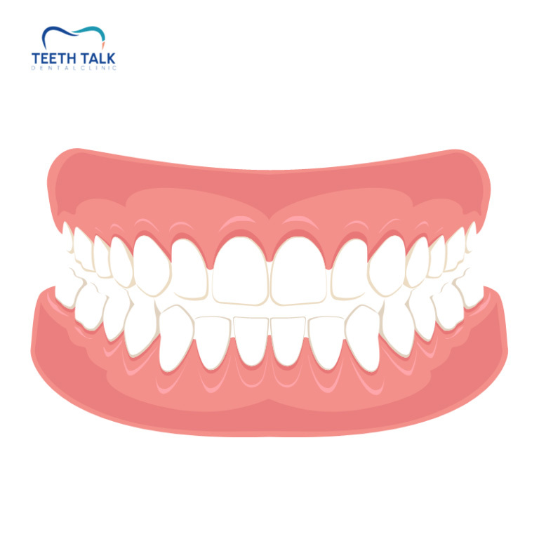 ฟันปลอมชนิดถอดได้ดีอย่างไร?