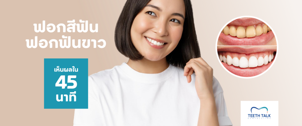 รอยยิ้มกระจ่างใส ฟอกสีฟัน Cool Light ราคาพิเศษ 2,999.- เท่านั้น!