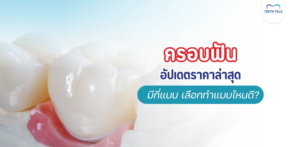ครอบฟัน ราคาเท่าไหร่
