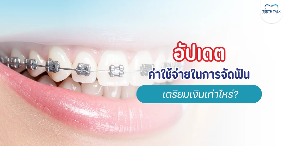 วางแผนค่าใช้จ่ายในการจัดฟัน