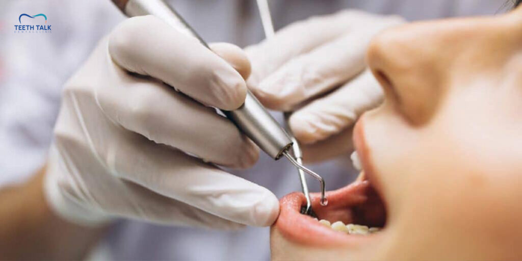 บริการขูดหินปูน