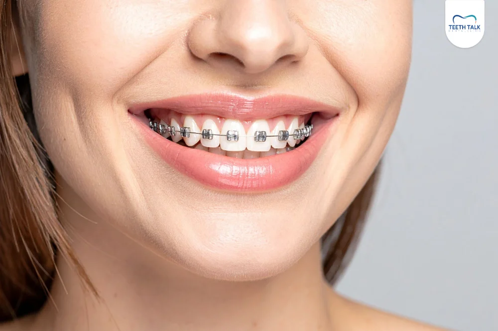 ขั้นตอนการจัดฟันไม่ผ่าตัดขากรรไกร