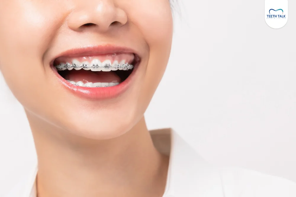 จัดฟันแบบไม่ถอนฟัน เลือกเครื่องมือแบบไหนดี