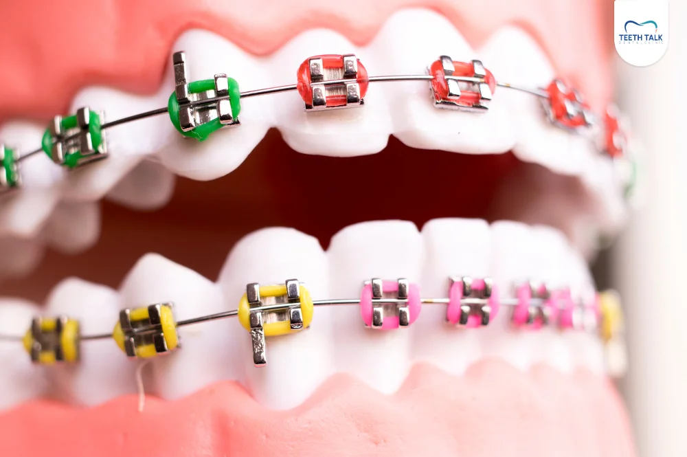 จัดฟันแฟชั่น แตกต่างจากการจัดฟันจริงอย่างไร