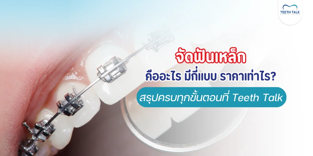 จัดฟันเหล็กดีอย่างไร