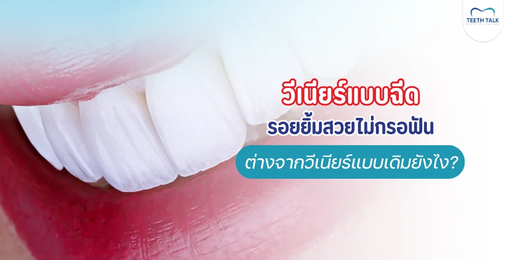 วีเนียร์แบบฉีด รอยยิ้มสวยไม่กรอฟัน