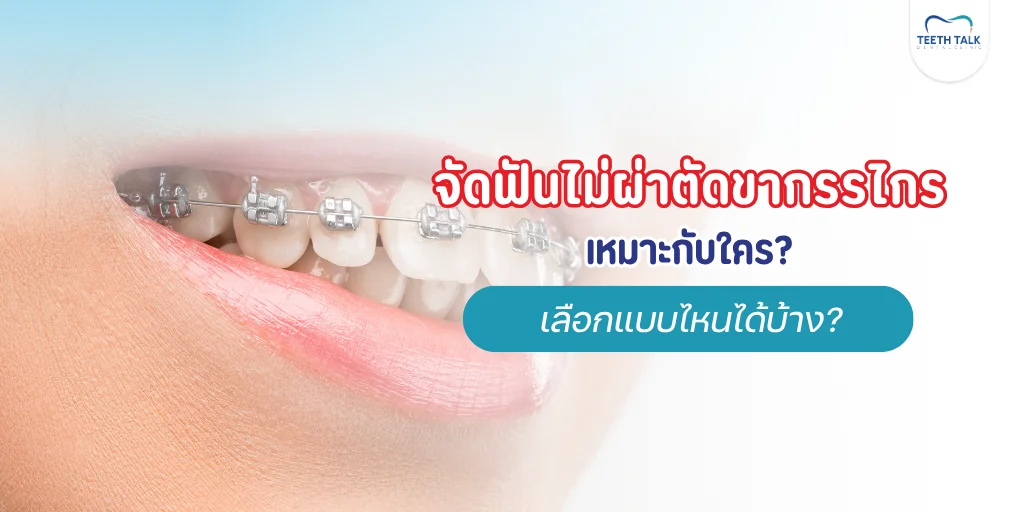 จัดฟันไม่ผ่าตัดขากรรไกร