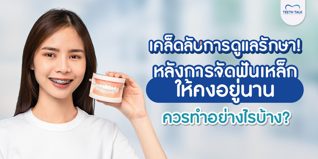เคล็ดลับการดูแลรักษา! หลังการจัดฟันเหล็ก ให้คงอยู่นาน ควรทำอย่างไรบ้าง?