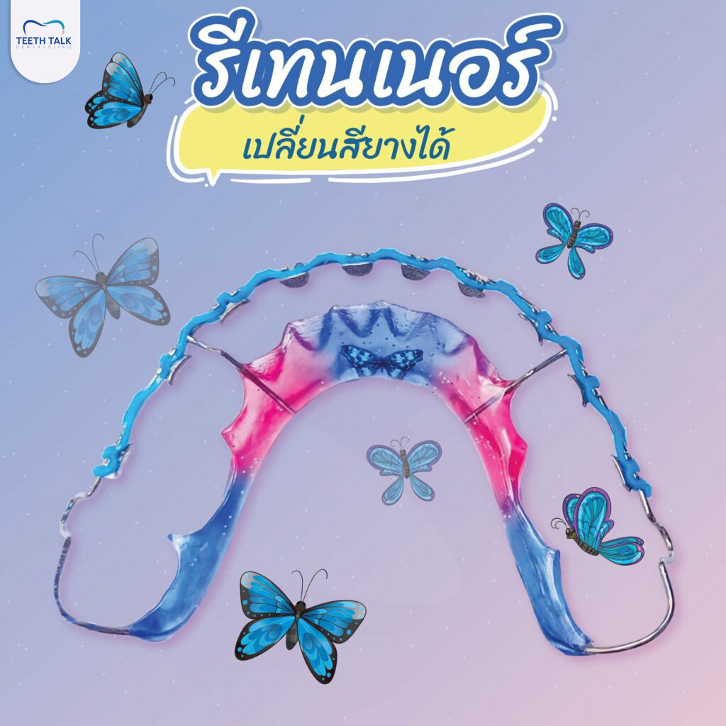 รีวิวว่ารีเทนเนอร์แบบแบล็คเก็ต ดีอย่างไร?