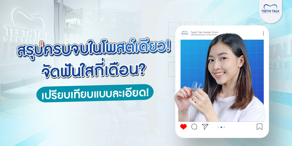 สรุปครบจบในโพสต์เดียว! จัดฟันใสกี่เดือน ? เปรียบเทียบแบบละเอียด!