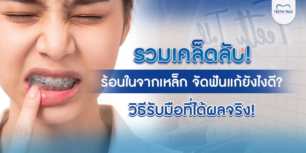 รวมเคล็ดลับ! ร้อนในจากเหล็กจัดฟัน แก้ยังไงดี? วิธีรับมือที่ได้ผลจริง!