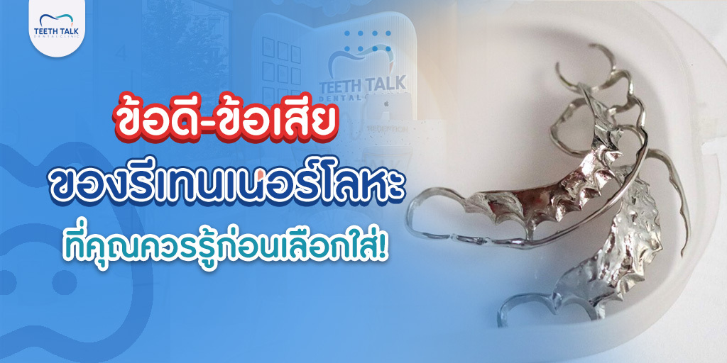 ข้อดี-ข้อเสียของ รีเทนเนอร์โลหะ ที่คุณควรรู้ก่อนเลือกใส่!